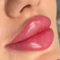 ژل لب روسی/بوتاکس/فیلر زیر چشم/زاویه فک لیزر بدن|خدمات آرایشگری و زیبایی|تهران, ستارخان|دیوار