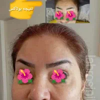 مدل بوتاکس رایگان جهت تبلیغات|خدمات آرایشگری و زیبایی|تهران, یافت آباد شمالی|دیوار