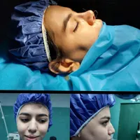 جشنواره بهاره  تزریق چربی جراحی پلک بلفارو بینی|خدمات آرایشگری و زیبایی|تهران, صادقیه|دیوار