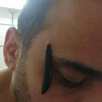 حجامت و زالودرمانی را در منزل خودتان تجربه کنید .|خدمات آرایشگری و زیبایی|اهواز, زیباشهر|دیوار