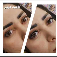 کاشت مژه حرفه ای