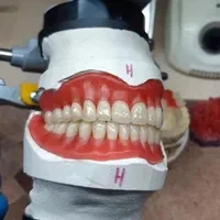 ساخت دندان مصنوعی ژله ای دریزد (دندانسازی)