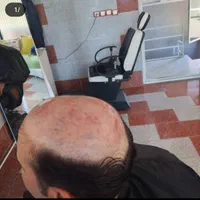ترمیم موی|خدمات آرایشگری و زیبایی|ری, دیلمان|دیوار
