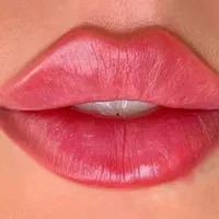 تخفیف لیزرمو،تزریق ژل لب بوتاکس هایفو لیفت صورت نخ|خدمات آرایشگری و زیبایی|تهران, ستارخان|دیوار