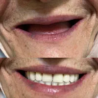 دندانسازی مرکزی ساخت انواع دندان مصنوعی|خدمات آرایشگری و زیبایی|یزد, |دیوار