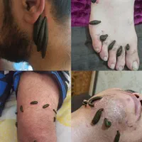 دیسک کمر سیاتیک فیزیوتراپی بادکش زالو درمانی حجامت|خدمات آرایشگری و زیبایی|تهران, سبلان (لشگر)|دیوار