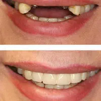 خدمات دندانپزشکی در مطب خصوصی با دو سال ضمانت|خدمات آرایشگری و زیبایی|یاسوج, |دیوار