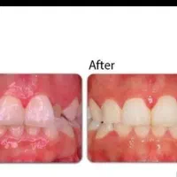 ارتودنسی اقساط بدون پیش پرداخت|خدمات آرایشگری و زیبایی|مشهد, شهرک رازی (شهرک غرب)|دیوار