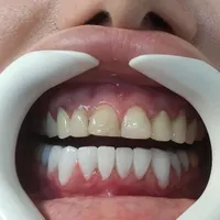 کلینیک تخصصی دندانپزشکی امین|خدمات آرایشگری و زیبایی|مشهد, چهارچشمه|دیوار