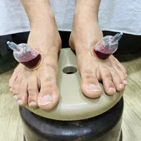 حجامت رفع مشکلات کبدی تیرگی پوست خستگی و غلظت خون|خدمات آرایشگری و زیبایی|ایلام, |دیوار