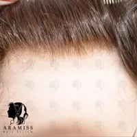 پروتز مو طبیعی فر و مجعد