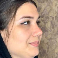 عمل جراحی بینی با بوتاکس رایگان فقط ۲۶،بدون تامپون|خدمات آرایشگری و زیبایی|تهران, یوسف‌آباد|دیوار
