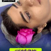 جراحی تخصصی بلفاروپلاستی با تکنیک جدید|خدمات آرایشگری و زیبایی|تهران, پاسداران|دیوار