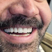 دندانسازی تخصصی (معاینه و مشاوره رایگان)|خدمات آرایشگری و زیبایی|بجنورد, |دیوار