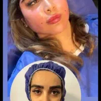 ساکشن شکم .غبغب .تزریق چربی .فیلر.پهلوتوسط پزشک|خدمات آرایشگری و زیبایی|کرمانشاه, |دیوار