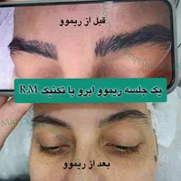 تخفیف ریموو تتو ابرو، خط چشم و لب در مرکز پوست غرب|خدمات آرایشگری و زیبایی|تهران, باغ فیض|دیوار