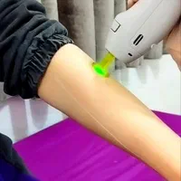 لیزر مو کندلا 2022 (سری شخصی )|خدمات آرایشگری و زیبایی|شوش, |دیوار