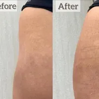 دوره جامع آموزش تزریق ژل،بوتاکس،لیفت نخ وفیلربادی|خدمات آموزشی|شاهین‌شهر, فردوسی|دیوار