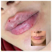 جشنوراه اقساطی ژل و بوتاکس با ضمانت بی قید و شرط|خدمات آرایشگری و زیبایی|تهران, میرداماد|دیوار