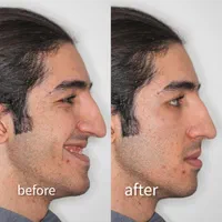 ارتودنسی ثابت ومتحرک|خدمات آرایشگری و زیبایی|شیراز, قصرالدشت|دیوار