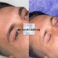 بوتاکس،فیلر،لیزر خانم و آقا،مزو،فیشال|خدمات آرایشگری و زیبایی|ری, دیلمان|دیوار