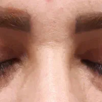 (شوش، شوشتر، اندیمشک) بلفاروپلاستی|خدمات آرایشگری و زیبایی|شوش, |دیوار