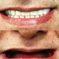دندانسازی مرکزی ساخت انواع دندان مصنوعی|خدمات آرایشگری و زیبایی|یزد, |دیوار