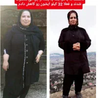لاغری غیرحضوری و حضوری با رکورددار جهان|خدمات آرایشگری و زیبایی|رشت, شالکو|دیوار