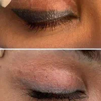 ژل،بوتاکس، لیزرخال و تاتو،ریمور|خدمات آرایشگری و زیبایی|قم, نیروگاه|دیوار