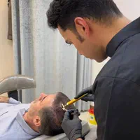 درمان تخصصی ریزش مو در کلینیک زیبایی راویس