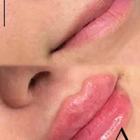 جشنواره تخفیف ویژه لیزر،ژل،بوتاکس،کلیه خدمات پزشکی|خدمات آرایشگری و زیبایی|ساری, |دیوار