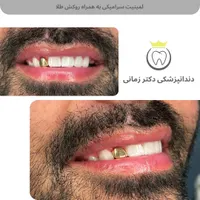 ارتودنسی نامرئی به روش دیجیتالی|خدمات آرایشگری و زیبایی|تهران, امیریه|دیوار