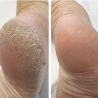 پاکسازی و فیشیال تخصصی پوست|خدمات آرایشگری و زیبایی|اصفهان, همدانیان|دیوار