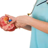 سنگ کلیه|آرایشی، بهداشتی، درمانی|مشهد, شهرک رازی (شهرک غرب)|دیوار