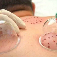 تزریق سرم درمنزل،انواع تزریقات وحجامت درمنزل|خدمات آرایشگری و زیبایی|کاشان, سه راه پرورشگاه|دیوار