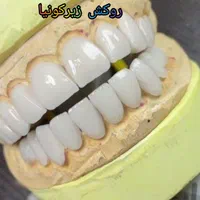 کلینیک تخصصی روکش و روکش ایمپلنت با تضمین کیفیت|خدمات آرایشگری و زیبایی|تبریز, |دیوار