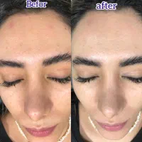 پاکسازی رایگان پوست مطهری