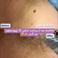 اپیلاسیون دائم،خالبرداری،لیفت ابرو،پارافین تراپی|خدمات آرایشگری و زیبایی|رشت, استقامت 2|دیوار