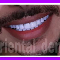 چک صیادی بلیچینگ ونیر جراحی دندان لیرینگ کامپوزیت|خدمات آرایشگری و زیبایی|تهران, تهران پارس|دیوار