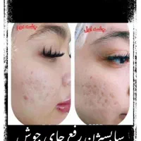 سابسیژن فیلر اندولیفت ژل بادی هایفو مزو بوتاکس|خدمات آرایشگری و زیبایی|کرج, مهرویلا جنوبی|دیوار