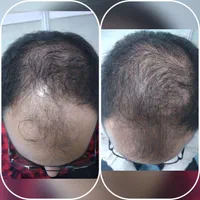 تزریقات وصل سرم امپول فصدخون مزوتراپی مو سرم تراپی|خدمات آرایشگری و زیبایی|مشهد, ده دی|دیوار