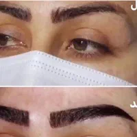 کاشت مو کاشت ابرو کاشت ریش تارکوب|خدمات آرایشگری و زیبایی|هشتگرد, |دیوار