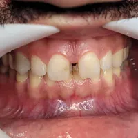 ارائه تمامی خدمات دندان پزشکی همراه با تخفیف ویژه