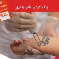 ریمو تتو.جوانسازی پوست. کربن تراپی. کربکسی تراپی