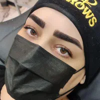 میکروبلیدینگ