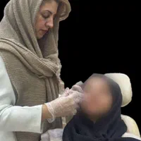 تزریق ژل بوتاکس لیزرمو مزو فیلرلب روسی لیفت صورت|خدمات آرایشگری و زیبایی|تهران, پونک|دیوار