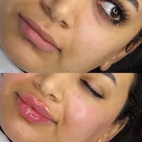 آموزش و انجام خدمات پوست و مو ژل و بوتاکس و..|خدمات آرایشگری و زیبایی|نور, |دیوار