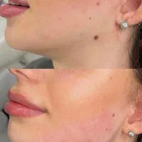 خدمات بالای سه میلیون با قبول چک‌|خدمات آرایشگری و زیبایی|مشهد, رضاشهر|دیوار