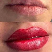 تزریق ژل و بوتاکس،ارایش دائم صورت(تاتو کل صورت)|خدمات آرایشگری و زیبایی|آزادشهر, |دیوار