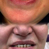کلیه خدمات دندانپزشکی/اقساط12ماهه/بدون کارمزد|خدمات آرایشگری و زیبایی|قم, حنیف نژاد|دیوار